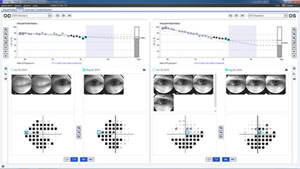 角膜形状解析装置　NIDEK社OPD-Scan Ⅲ